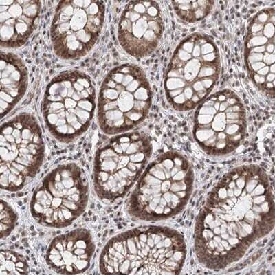 Immunohistochemistry-Paraffin FAM13C1 Antibody - BSA Free
