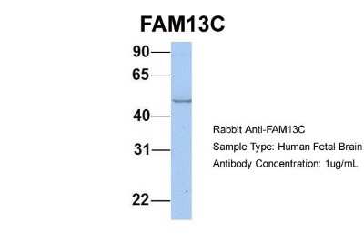 Western Blot: FAM13C1 Antibody [NBP1-56524] - Human Fetal Brain, Antibody Dilution: 1.0 ug/ml.