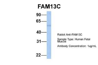 Western Blot: FAM13C1 Antibody [NBP1-56524] - Human Fetal Muscle, Antibody Dilution: 1.0 ug/ml.
