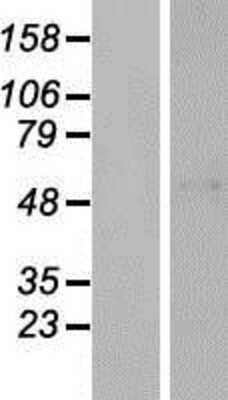 Western Blot: FAM13C1 Overexpression Lysate (Adult Normal) [NBP2-10725] Left-Empty vector transfected control cell lysate (HEK293 cell lysate); Right -Over-expression Lysate for FAM13C1.
