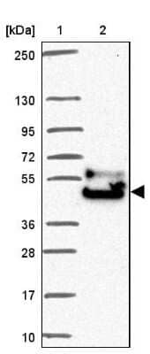 Western Blot: FAM149A Antibody [NBP2-30831] - Lane 1: Marker  [kDa] 250, 130, 95, 72, 55, 36, 28, 17, 10.  Lane 2: Human cell line RT-4
