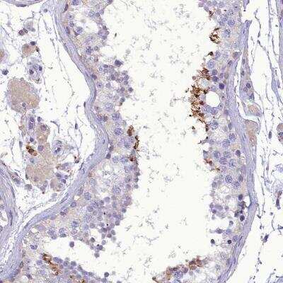 Immunohistochemistry-Paraffin: FAM149B1 Antibody [NBP1-81452] - Staining of human testis shows strong cytoplasmic positivity in cells in seminiferous ducts.