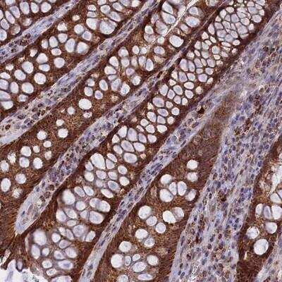 Immunohistochemistry: FAM149B1 Antibody [NBP2-13982] - Staining of human rectum shows strong cytoplasmic positivity in glandular cells.