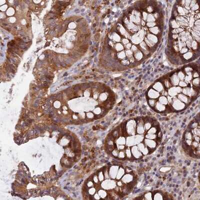 Immunohistochemistry-Paraffin: FAM151B Antibody [NBP1-90647] - Staining of human colon shows moderate cytoplasmic positivity in glandular cells.