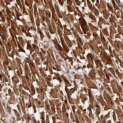 Immunohistochemistry FAM153A Antibody - BSA Free