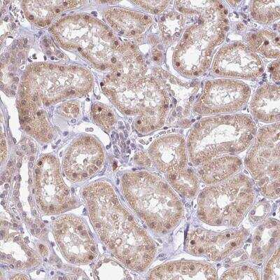 Immunohistochemistry FAM153A Antibody - BSA Free