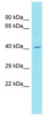 Western Blot: FAM153B Antibody [NBP3-10771] - Western blot analysis of FAM153B in MDA-MB-435s Whole cell lysates. Antibody dilution at 1.0ug/ml