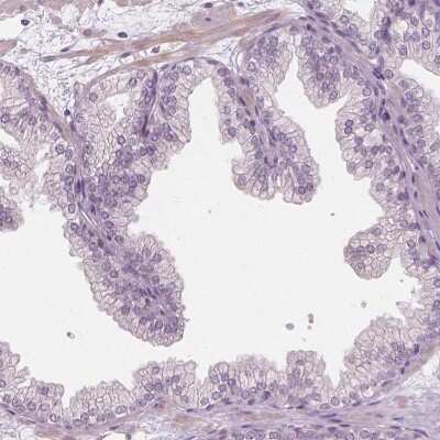 Immunohistochemistry-Paraffin: FAM154B Antibody [NBP1-90520] - Staining of human prostate shows low expression as expected.