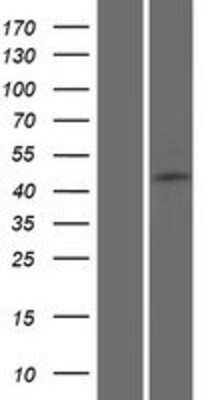 Western Blot: FAM154B Overexpression Lysate (Adult Normal) [NBP2-08803] Left-Empty vector transfected control cell lysate (HEK293 cell lysate); Right -Over-expression Lysate for FAM154B.