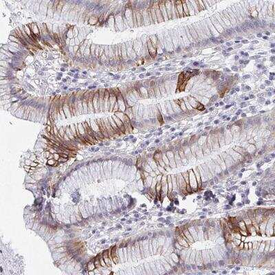 Immunohistochemistry: FAM156A Antibody [NBP2-46837] - Staining of human stomach, lower shows distinct cytoplasmic and membranous positivity in glandular cells.
