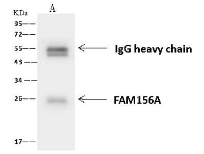 Immunoprecipitation: FAM156A Antibody [NBP2-97746] - FAM156A was immunoprecipitated using: Lane A: 0.5 mg U-251 MG Whole Cell Lysate 4 ul anti-FAM156A rabbit polyclonal antibody and 60 ug of Immunomagnetic beads Protein A/G.  Primary antibody: Anti-FAM156A rabbit polyclonal antibody, at 1:100 dilution. Secondary antibody: Goat Anti-Rabbit IgG (H+L)/HRP at 1/10000 dilution. Developed using the ECL technique. Performed under reducing conditions. Predicted band size: 24 kDa. Observed band size: 24 kDa