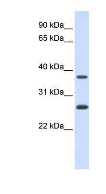 Western Blot: FAM156A Antibody [NBP1-80458] - Titration: 0.2-1 ug/ml, Positive Control: Human Lung.