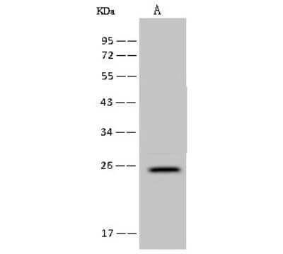 Western Blot: FAM156A Antibody [NBP2-97746] - Anti-FAM156A rabbit polyclonal antibody at 1:500 dilution. Lane A: U-251 MG Whole Cell Lysate Lysates/proteins at 30 ug per lane. Secondary Goat Anti-Rabbit IgG (H+L)/HRP at 1/10000 dilution. Developed using the ECL technique. Performed under reducing conditions. Predicted band size: 24 kDa. Observed band size: 24 kDa