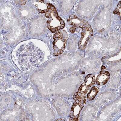 Immunohistochemistry: FAM159A Antibody [NBP2-48597] - Staining of human kidney shows strong cytoplasmic and membranous positivity in cells in tubules.