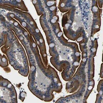 Immunohistochemistry: FAM159B Antibody [NBP1-91103] - Staining of human duodenum shows strong luminal membranous and cytoplasmic positivity in glandular cells.