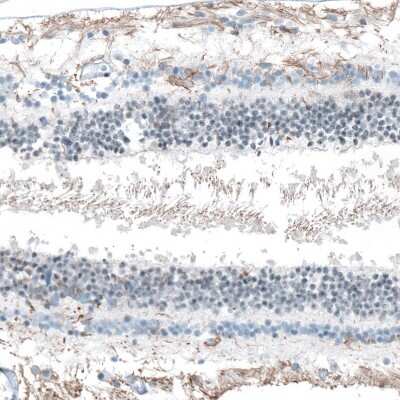 Immunohistochemistry-Paraffin: FAM161A Antibody [NBP1-94022] - Staining of human outer plexiform layer shows moderate positivity in cilium basal body.