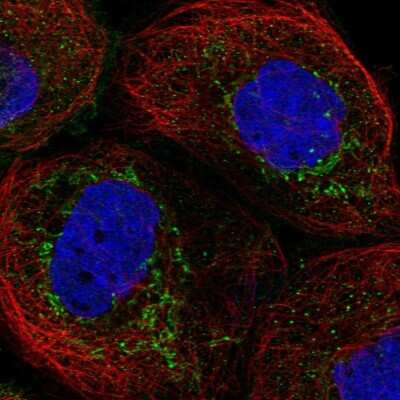 Immunocytochemistry/Immunofluorescence: FAM162A Antibody [NBP1-86792] - Immunofluorescent staining of human cell line A-431 shows localization to mitochondria.