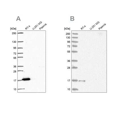 <b>Independent Antibodies Validation. </b>Western Blot: FAM162A Antibody [NBP2-58663] - Analysis using Anti-FAM162A antibody NBP2-58663 (A) shows similar pattern to independent antibody NBP1-86792 (B).