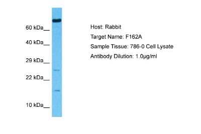 Western Blot: FAM162A Antibody [NBP2-84893] - Host: Rabbit. Target Name: F162A. Sample Type: 786-0 Whole Cell lysates. Antibody Dilution: 1.0ug/ml