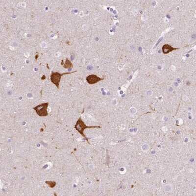 Immunohistochemistry-Paraffin: FAM163B Antibody [NBP2-57157] - Immunohistochemical staining of human cerebral cortex shows cytoplasmic positivity in neuronal cells.