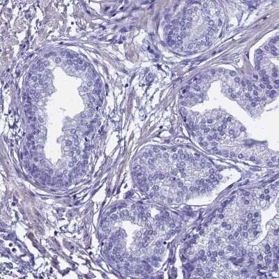 Immunohistochemistry-Paraffin: FAM166B Antibody [NBP1-94176] - Staining of human prostate shows low expression as expected.
