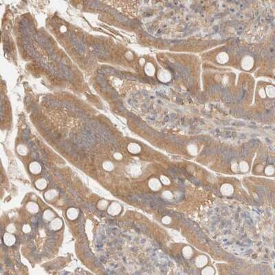 Immunohistochemistry-Paraffin: FAM167A Antibody [NBP1-91237] - Staining of human small intestine shows moderate cytoplasmic positivity in glandular cells.