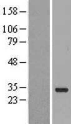 Western Blot: FAM167A Overexpression Lysate (Adult Normal) [NBP2-05815] Left-Empty vector transfected control cell lysate (HEK293 cell lysate); Right -Over-expression Lysate for FAM167A.