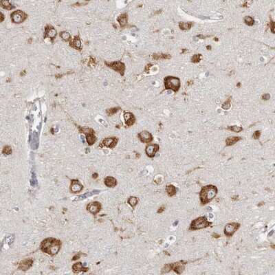 Immunohistochemistry-Paraffin: FAM167B Antibody [NBP1-88321] - Staining of human cerebral cortex shows strong cytoplasmic positivity in neuronal cells.