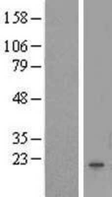 Western Blot: FAM167B Overexpression Lysate (Adult Normal) [NBL1-10494] Left-Empty vector transfected control cell lysate (HEK293 cell lysate); Right -Over-expression Lysate for FAM167B.