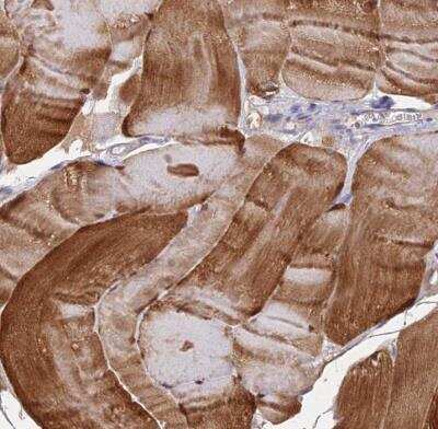 Immunohistochemistry-Paraffin: FAM168B Antibody [NBP1-93650] - Staining of human skeletal muscle shows strong cytoplasmic and nuclear positivity in myocytes.