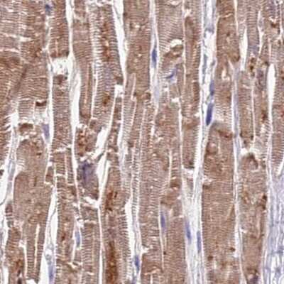 Immunohistochemistry-Paraffin: FAM168B Antibody [NBP1-93650] - Staining of human heart muscle.