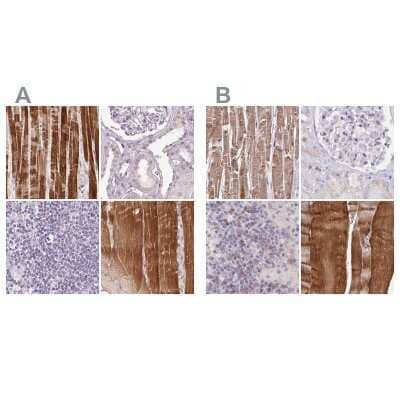<b>Independent Antibodies Validation. </b>Immunohistochemistry-Paraffin: FAM168B Antibody [NBP2-49343] - Staining of human heart muscle, kidney, lymph node and skeletal muscle using Anti-FAM168B antibody NBP2-49343 (A) shows similar protein distribution across tissues to independent antibody NBP1-93650 (B).