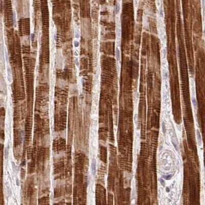 Immunohistochemistry-Paraffin: FAM168B Antibody [NBP2-49343] - Staining of human heart muscle.