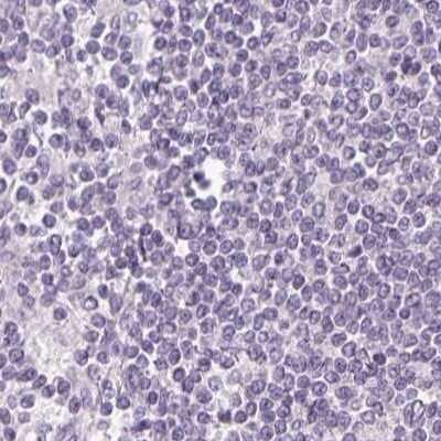 Immunohistochemistry-Paraffin: FAM168B Antibody [NBP2-49343] - Staining of human lymph node.