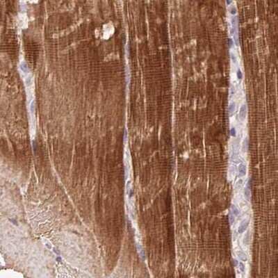 Immunohistochemistry-Paraffin: FAM168B Antibody [NBP2-49343] - Staining of human skeletal muscle.