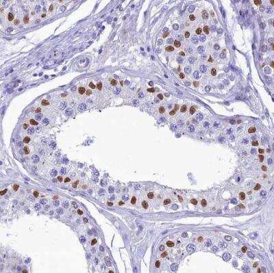Immunohistochemistry-Paraffin: FAM169A Antibody [NBP1-93616] - Staining of human testis shows strong nuclear positivity in seminiferous ducts.