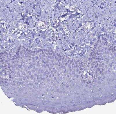 Immunohistochemistry-Paraffin: FAM169A Antibody [NBP1-93616] - Staining of human skin shows no positivity in squmaous epithelial cells as expected.