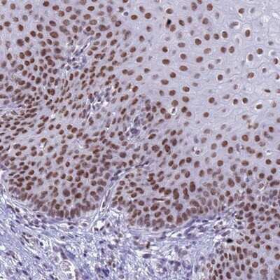 Immunohistochemistry-Paraffin: FAM170b Antibody [NBP2-13985] - Staining of human esophagus shows strong nuclear positivity in squamous epithelial cells.