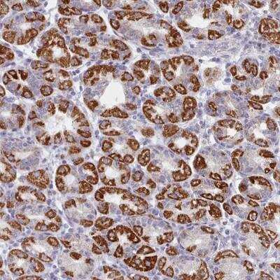 Immunohistochemistry-Paraffin: FAM170b Antibody [NBP2-13986] - Staining of human stomach, upper shows strong cytoplasmic positivity in glandular cells.