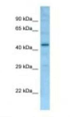 Western Blot: FAM170b Antibody [NBP1-98265] - Mouse Liver Lysate 1.0 ug/ml, Gel Concentration 12%