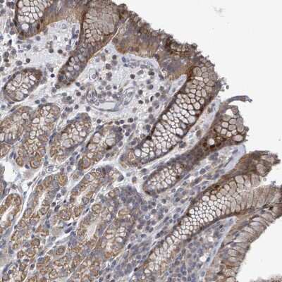 Immunohistochemistry-Paraffin: FAM171A1 Antibody [NBP2-13987] - Staining of human stomach, upper shows moderate cytoplasmic and nuclear positivity in glandular cells.