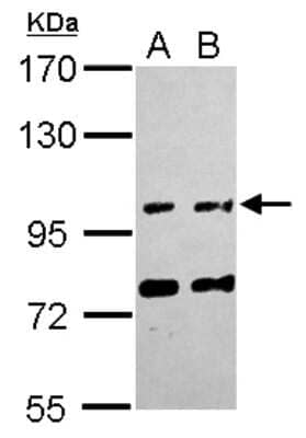 Western Blot: FAM171A1 Antibody [NBP2-16414] - Sample (30 ug of whole cell lysate) A: HepG2 B: HCT116 7. 5% SDS PAGE gel, diluted at 1:1000.