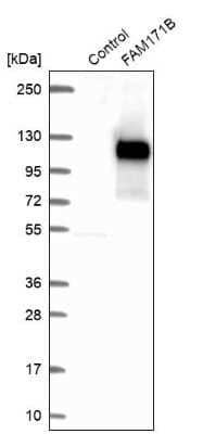 Western Blot: FAM171B Antibody [NBP1-93846] - Analysis in control (vector only transfected HEK293T lysate) and FAM171B over-expression lysate (Co-expressed with a C-terminal myc-DDK tag (3.1 kDa) in mammalian HEK293T cells).