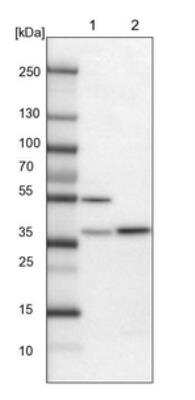 Western Blot: FAM171B Antibody [NBP1-93847] - Lane 1: Mouse liver tissue lysate.  Lane 2: Rat liver tissue lysate.