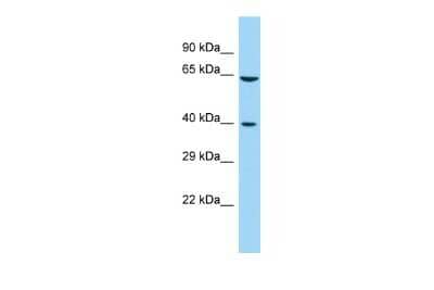 Western Blot: FAM172A Antibody [NBP2-84900] - Host: Rabbit. Target Name: FAM172A. Sample Type: Fetal Kidney lysates. Antibody Dilution: 1.0ug/ml