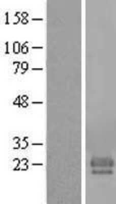 Western Blot: FAM174A Overexpression Lysate (Adult Normal) [NBL1-10499] Left-Empty vector transfected control cell lysate (HEK293 cell lysate); Right -Over-expression Lysate for FAM174A.