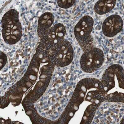 Immunohistochemistry-Paraffin FAM174B Antibody - BSA Free