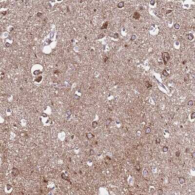 Immunohistochemistry: FAM176B Antibody [NBP2-31929] - Staining of human cerebral cortex shows strong cytoplasmic positivity in neuronal cells.