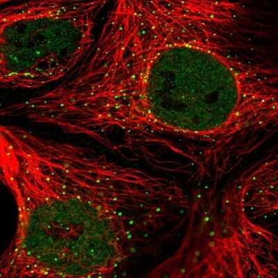 Immunocytochemistry/Immunofluorescence: FAM177A1 Antibody [NBP2-33293] - Immunofluorescent staining of human cell line CACO-2 shows localization to nucleoplasm & vesicles.
