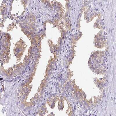 Immunohistochemistry: FAM177A1 Antibody [NBP2-33293] - Staining of human prostate shows moderate cytoplasmic positivity in glandular cells.